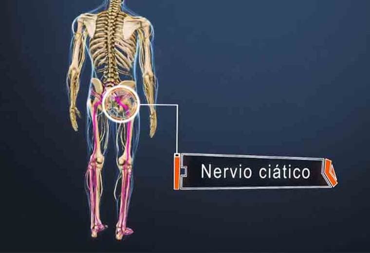 ¿Qué es el nervio ciático?