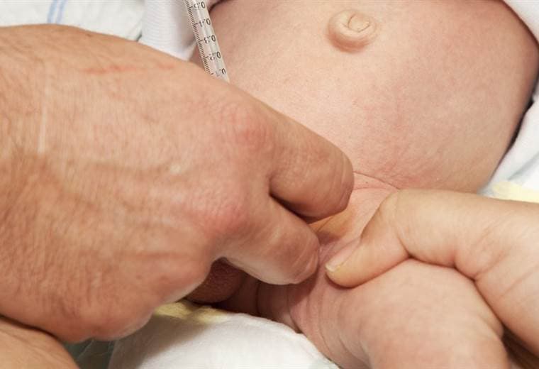 Por una circuncisión casera muere un bebé de cinco meses en Italia