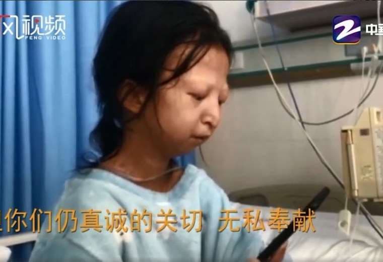 Muere Wu Huayan, la joven china que se alimentó solo de arroz y chiles durante 5 años