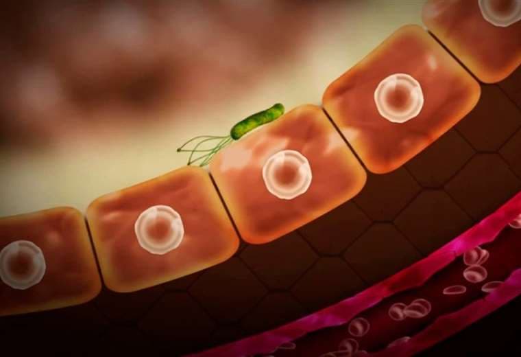 Aprenda a detectar la bacteria que causa infecciones en el estómago