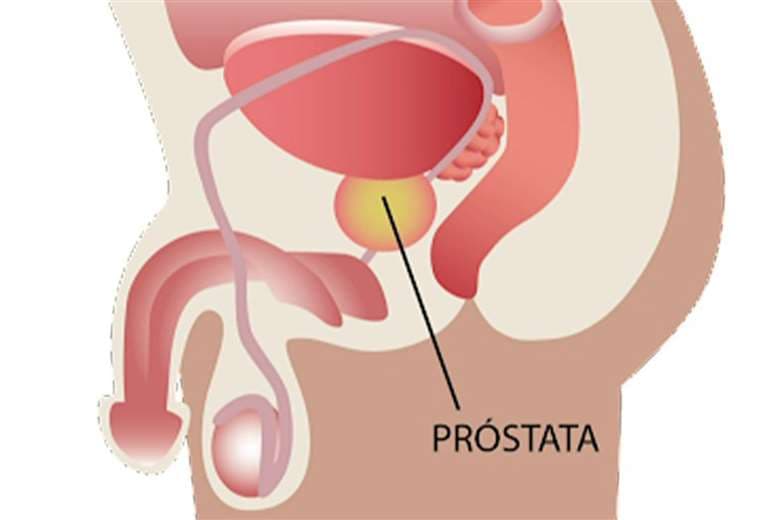 Estos son los padecimientos más comunes asociados a la próstata