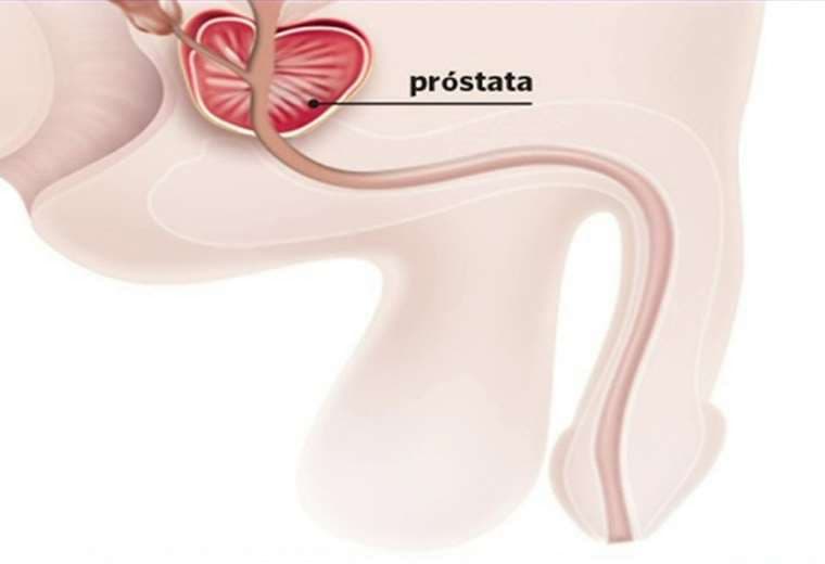 El rol clave de la fisioterapia antes y después de una cirugía de próstata