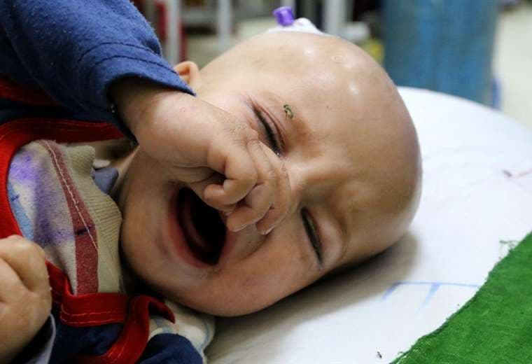 Niños mueren de desnutrición en hospital: "Joven rogaba que la mataran a ella y a su bebé"