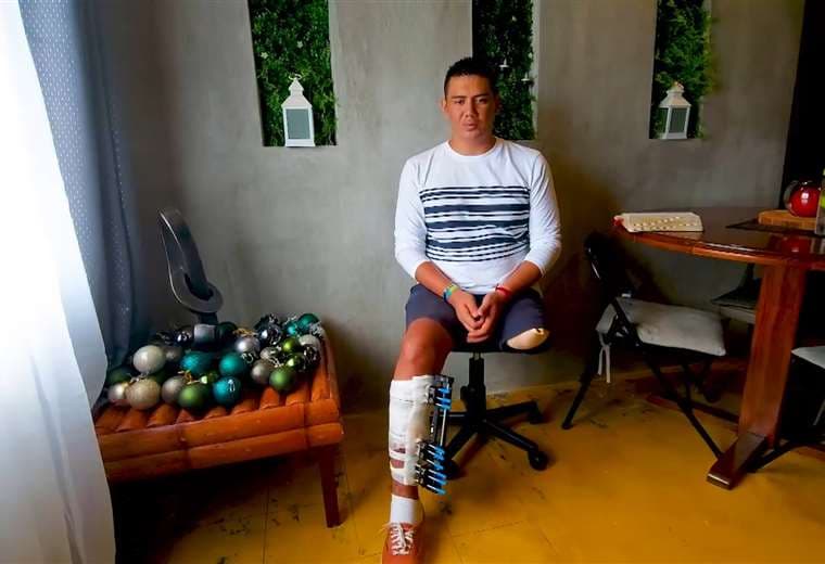 Joven emprende campaña para comprar prótesis de su pierna
