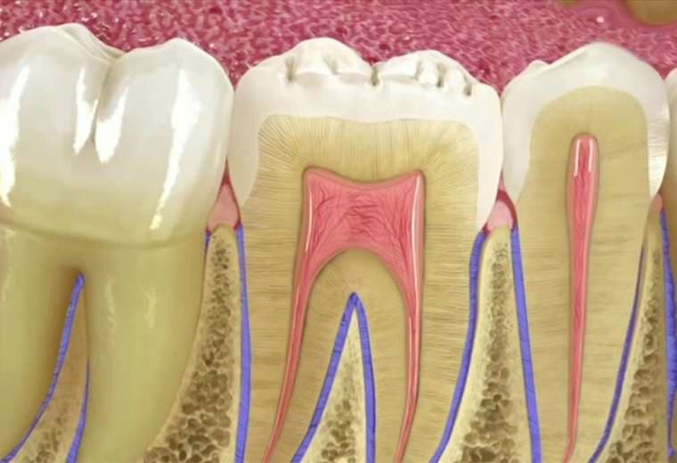 Evite la pérdida de piezas dentales 