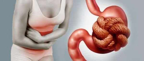 ¿Qué es lo que se conoce como intestino perezoso?