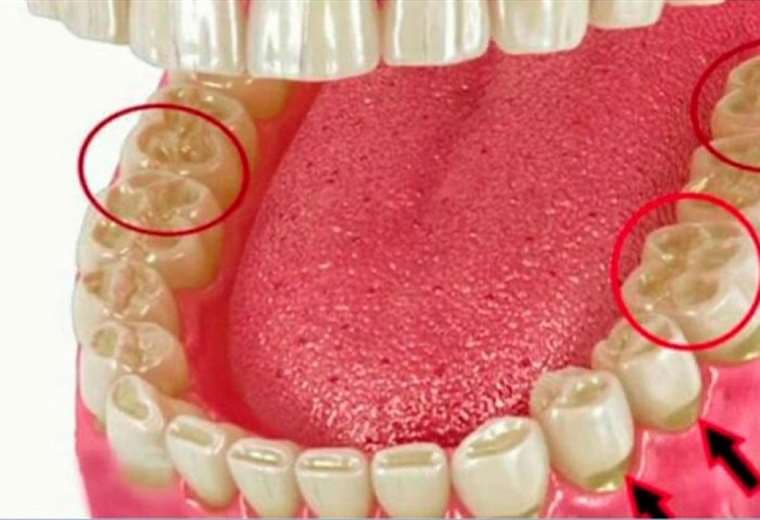 Conozca los tratamientos para la quebradura dental