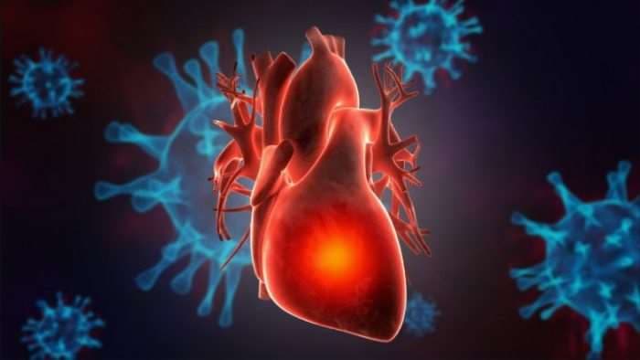 ¿Sabía que el COVID-19 puede inflamar el corazón?