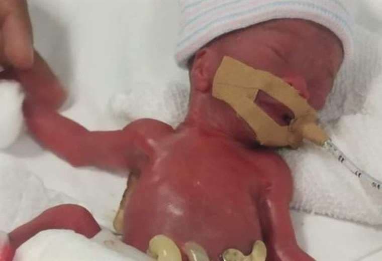 La bebé "más pequeña al nacer" se va a casa tras 13 meses hospitalizada