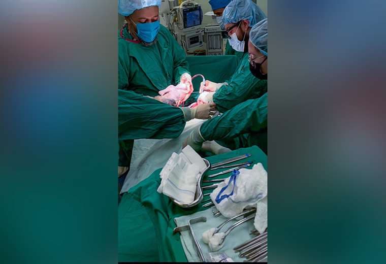 Así fue como 10 especialistas salvaron la vida de una mamá y su bebé durante una compleja cesárea