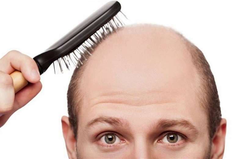 ¿Cómo se puede tratar la pérdida crónica de cabello?