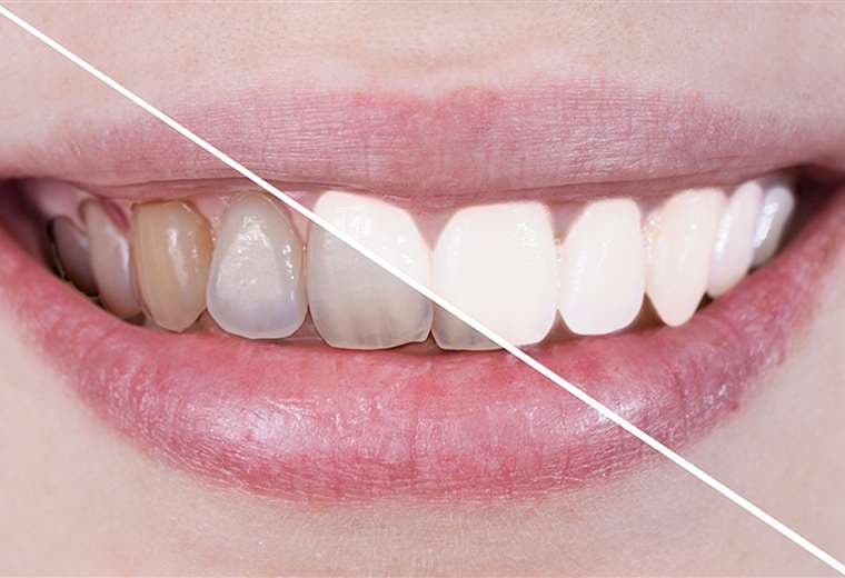 El secreto para tener dientes más blancos