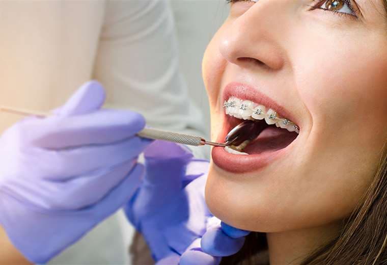 En defensa de las extracciones por ortodoncia