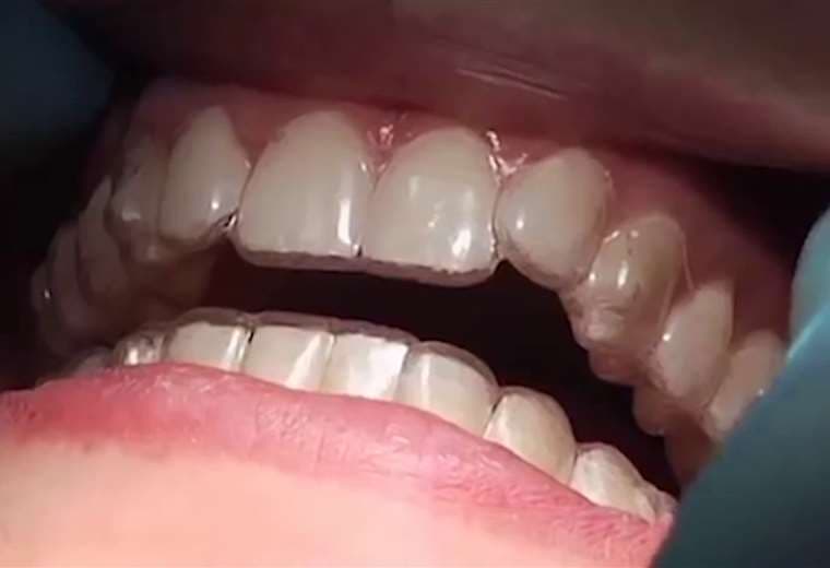 Hablamos sobre ortodoncia invisible para niños
