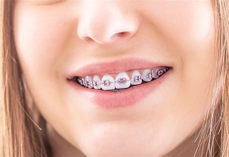 ¡Adiós a los mitos sobre la ortodoncia!