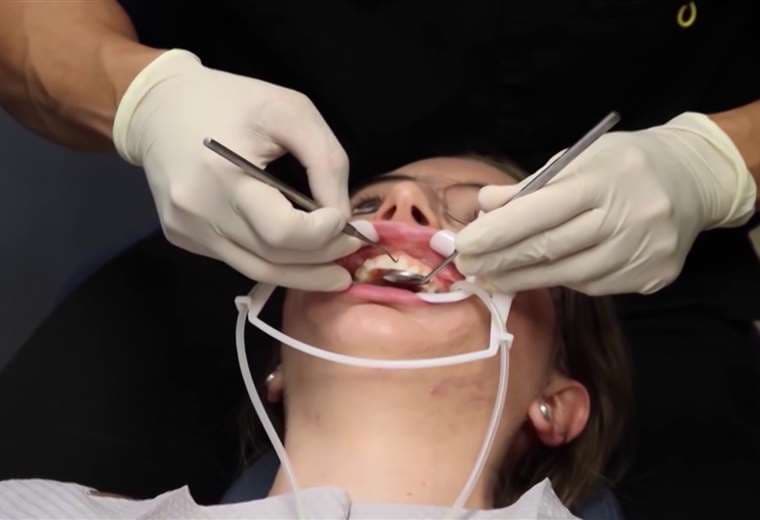 Conozca los tipos de retenedores de ortodoncia