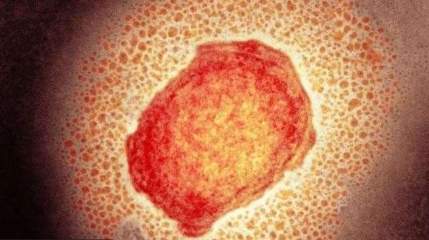 Uno más: ya son 24 los casos de viruela símica en Costa Rica