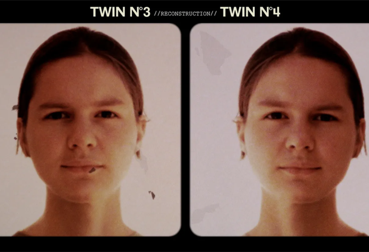 Las gemelas separadas al nacer como parte de un oscuro experimento que se reencontraron décadas después