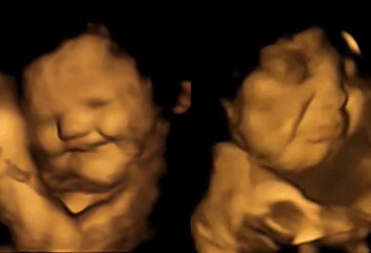 Estudio mostró que bebés en el vientre "sonríen" cuando sus mamás comen zanahorias
