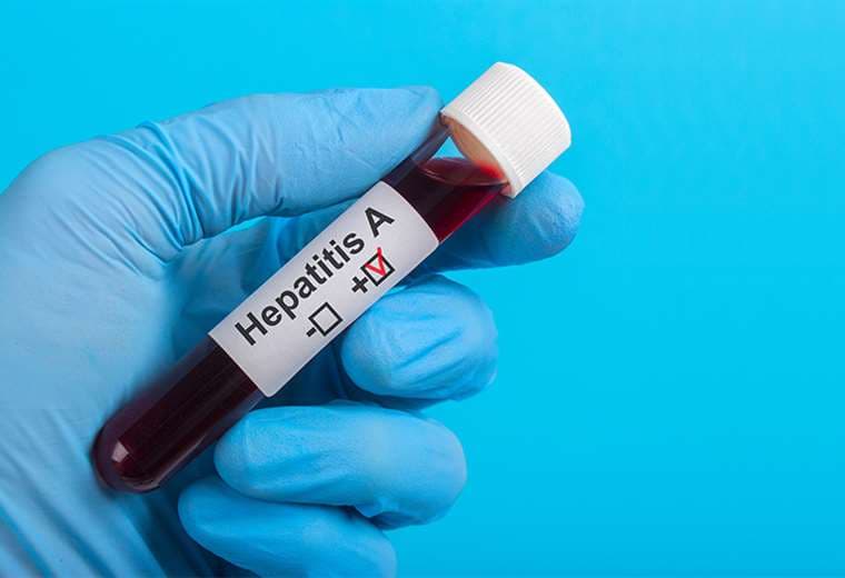 Salud confirma 14 casos de hepatitis A, pero descarta brote en este momento