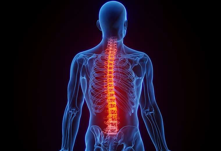 Espondilitis anquilosante, una de las muchas causas del dolor de espalda
