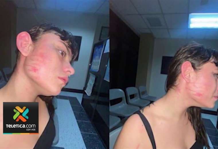 Abogado de policías denunciados por agresión asegura que joven se "mostró violenta"