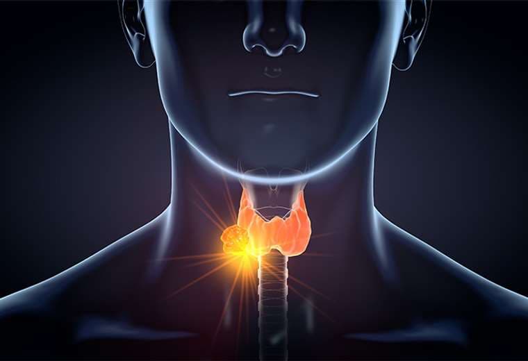 Guía para pacientes: Todo lo que tiene que saber sobre el cáncer de tiroides