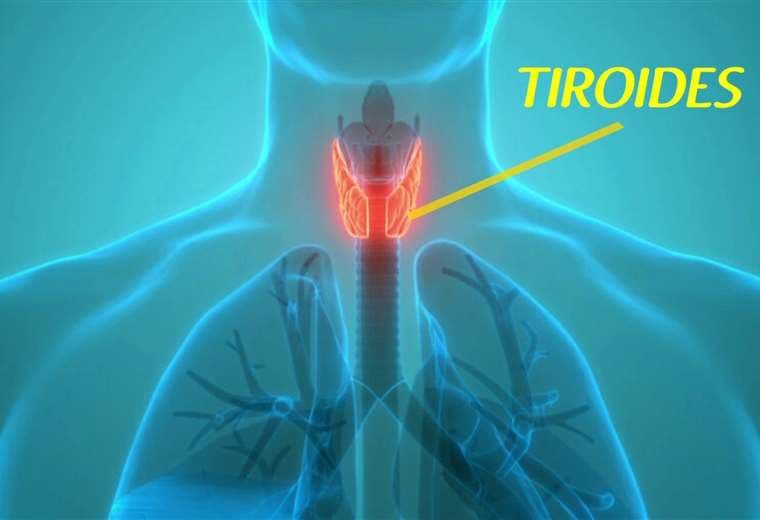 Tiroiditis Todo lo que necesita saber sobre la tiroiditis de Hashimoto | Teletica